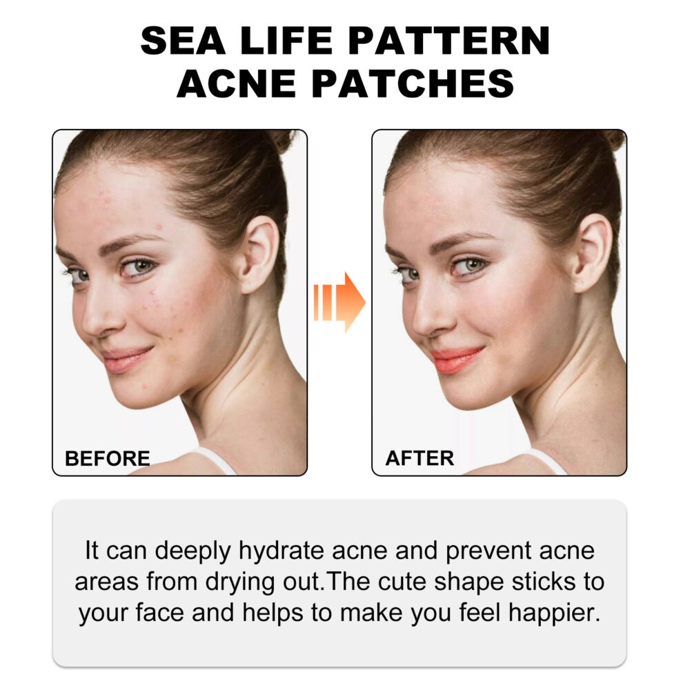 Sea Life Pattern Acne Patches, Reduce Pimples Anti-Dryness Deep Hydrating Facial Cleanser #JL05-w13123850 - Image 2