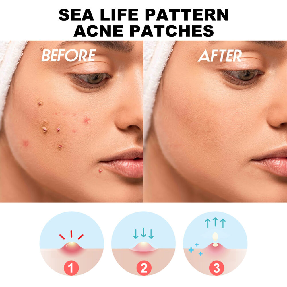 Sea Life Pattern Acne Patches, Reduce Pimples Anti-Dryness Deep Hydrating Facial Cleanser #JL05-w13123850 - Image 8