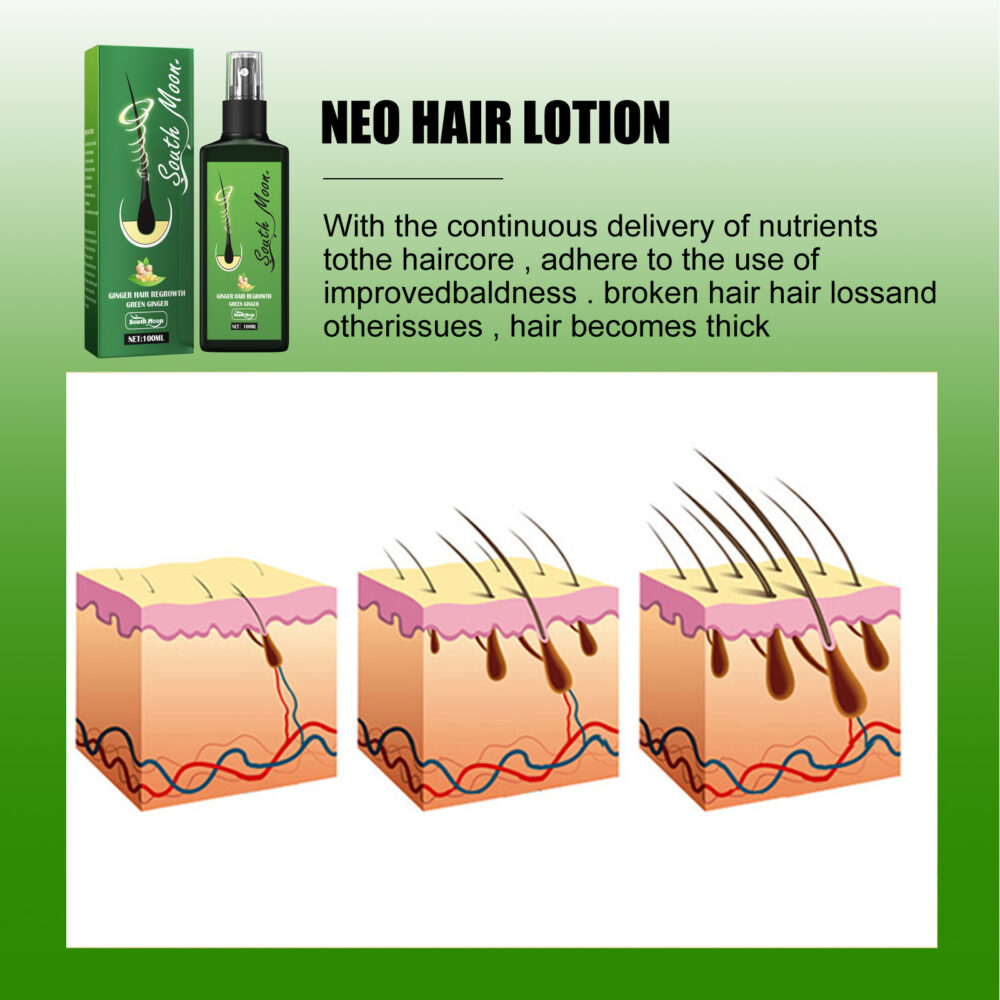 Ginger Hair Regrowth Green Ginger, Moisturizing And Hydrating Scalp Care Solution #JL05-w13073615 - Image 8