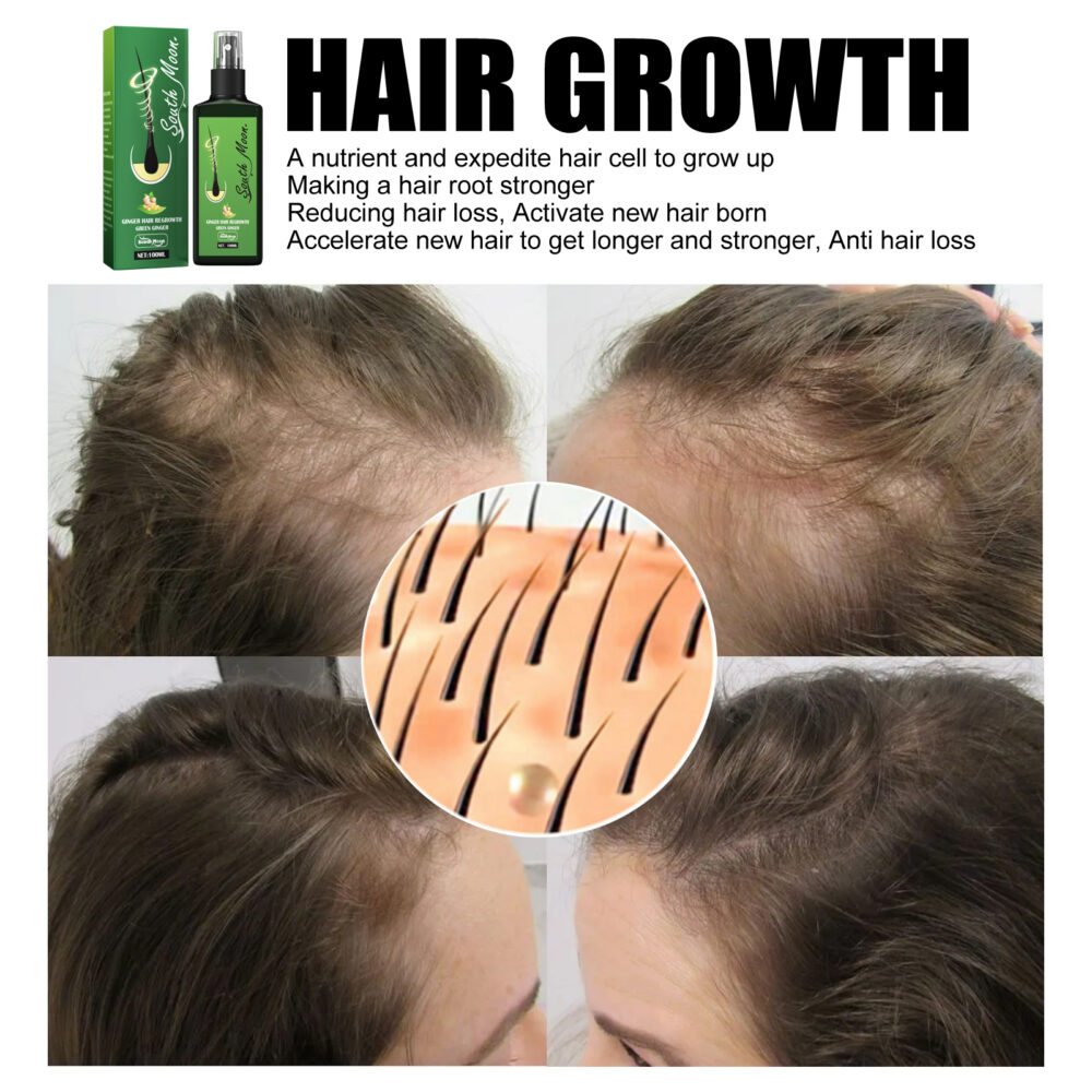 Ginger Hair Regrowth Green Ginger, Moisturizing And Hydrating Scalp Care Solution #JL05-w13073615 - Image 6