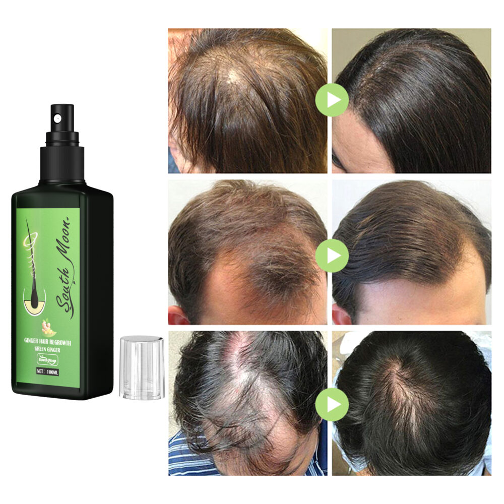 Ginger Hair Regrowth Green Ginger, Moisturizing And Hydrating Scalp Care Solution #JL05-w13073615 - Image 3