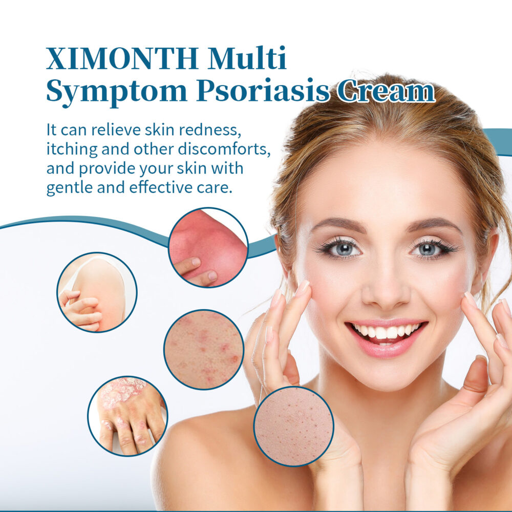 Multi Symptom Psoriasis Cream, Repair Hands And Feet Body Moss Red And Itchy Skin Topical Care Cream #JL05-w13123954 - Image 7