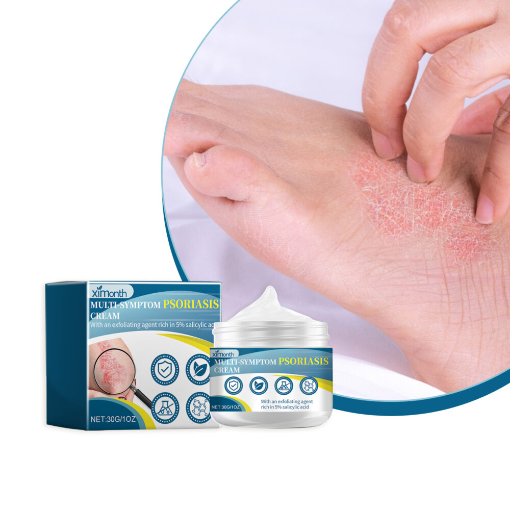 Multi Symptom Psoriasis Cream, Repair Hands And Feet Body Moss Red And Itchy Skin Topical Care Cream #JL05-w13123954 - Image 4