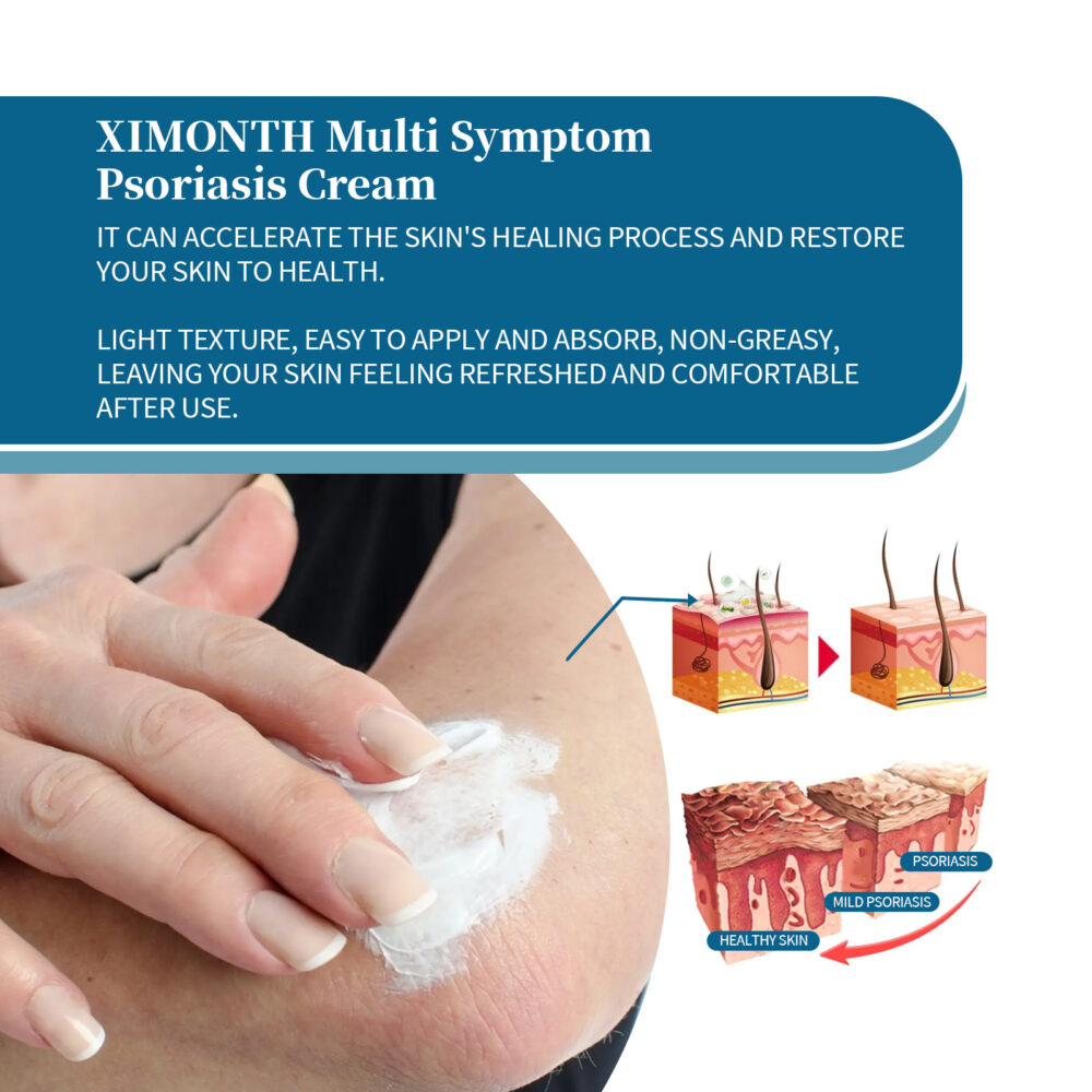 Multi Symptom Psoriasis Cream, Repair Hands And Feet Body Moss Red And Itchy Skin Topical Care Cream #JL05-w13123954 - Image 3