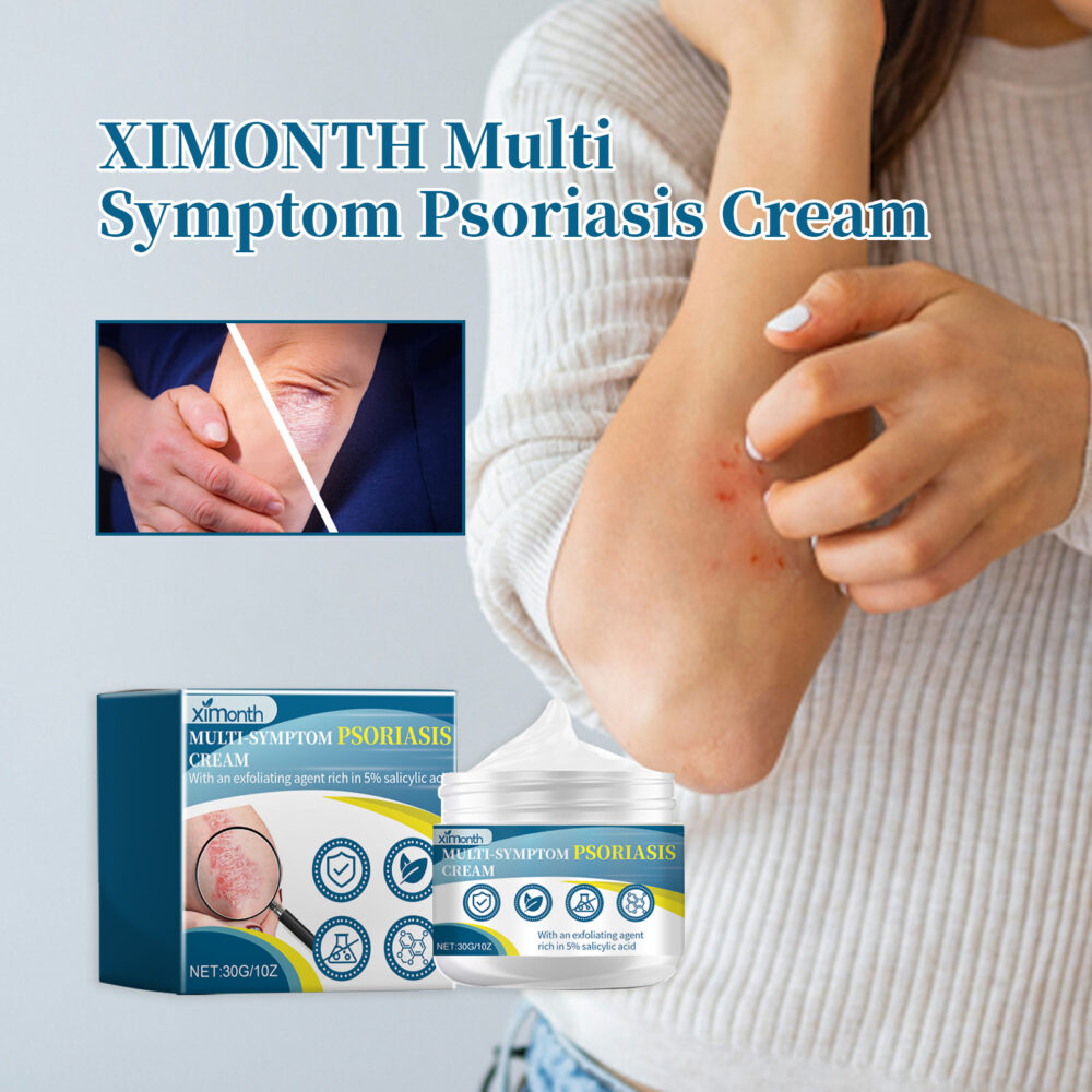 Multi Symptom Psoriasis Cream, Repair Hands And Feet Body Moss Red And Itchy Skin Topical Care Cream #JL05-w13123954