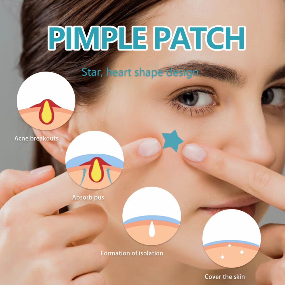 Hydrocolloidal Acne Patch, Repair Acne Acne Cleansing Invisible Breathable Waterproof Acne Cleansing Concealer #JL05-w13123937 - Image 4