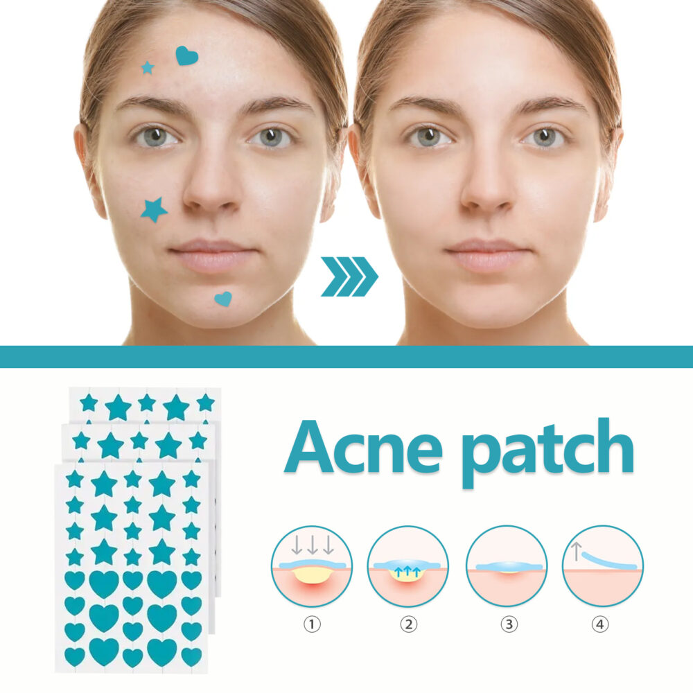 Hydrocolloidal Acne Patch, Repair Acne Acne Cleansing Invisible Breathable Waterproof Acne Cleansing Concealer #JL05-w13123937 - Image 8