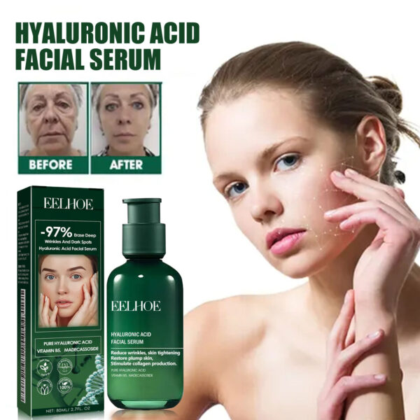 EELHOE Facial Essence, Lifts And Tightens Facial Skin And Reduces Fine Lines And Wrinkles #WYL-w13123793