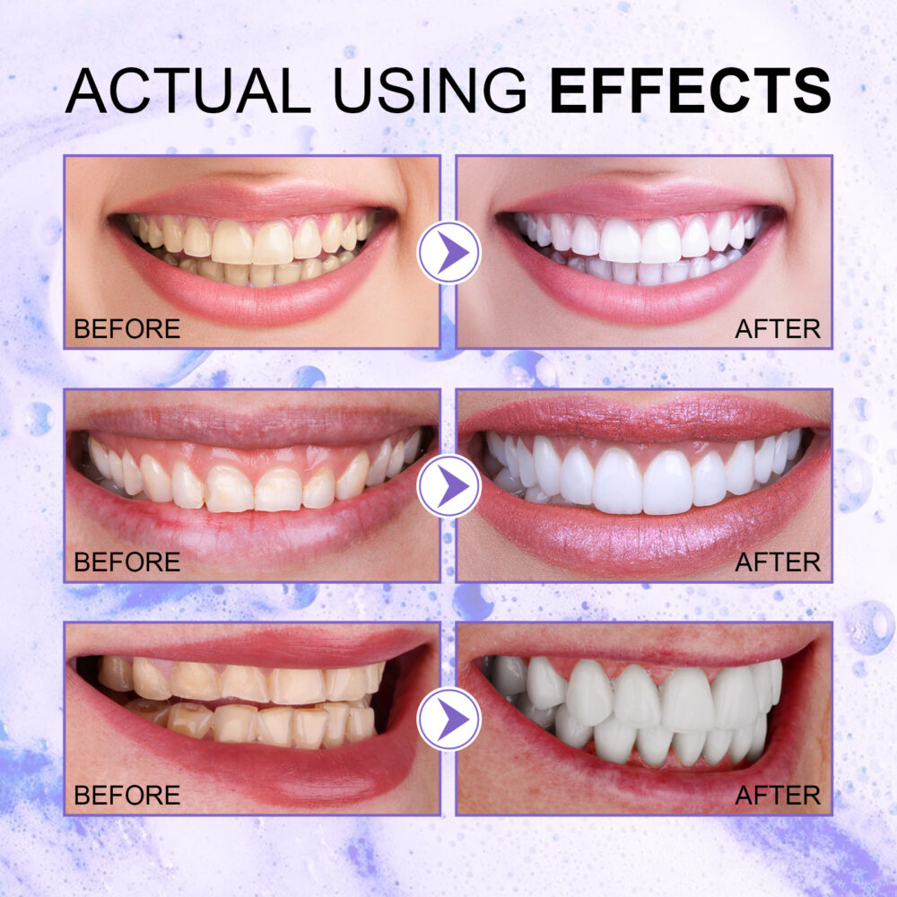 Purple Tooth Whitening Toothpaste, Brightens Teeth Cleans Stains And Relieves Bad Breath Beautiful Teeth Toothpaste #JL05-w13101728 - Image 6