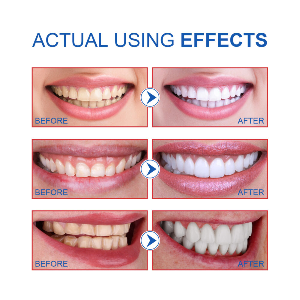 Probiotic Brightening Toothpaste, Oral Cleaning Remove Odor Stains White Teeth Gum Care Toothpaste #WYL-w13199039 - Image 5