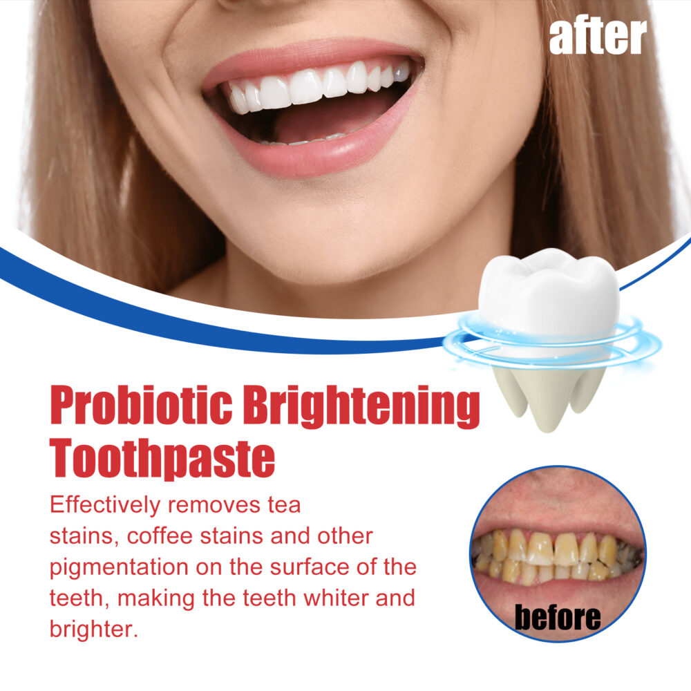 Probiotic Brightening Toothpaste, Oral Cleaning Remove Odor Stains White Teeth Gum Care Toothpaste #WYL-w13199039 - Image 8