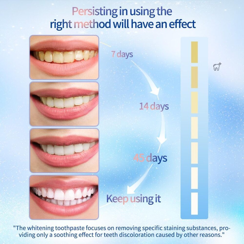 Nicotinamide toothpaste #JL02-A313-NT001 - Image 8