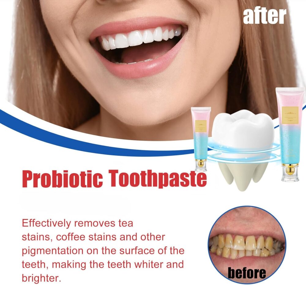 Nicotinamide toothpaste #JL02-A313-NT001 - Image 5