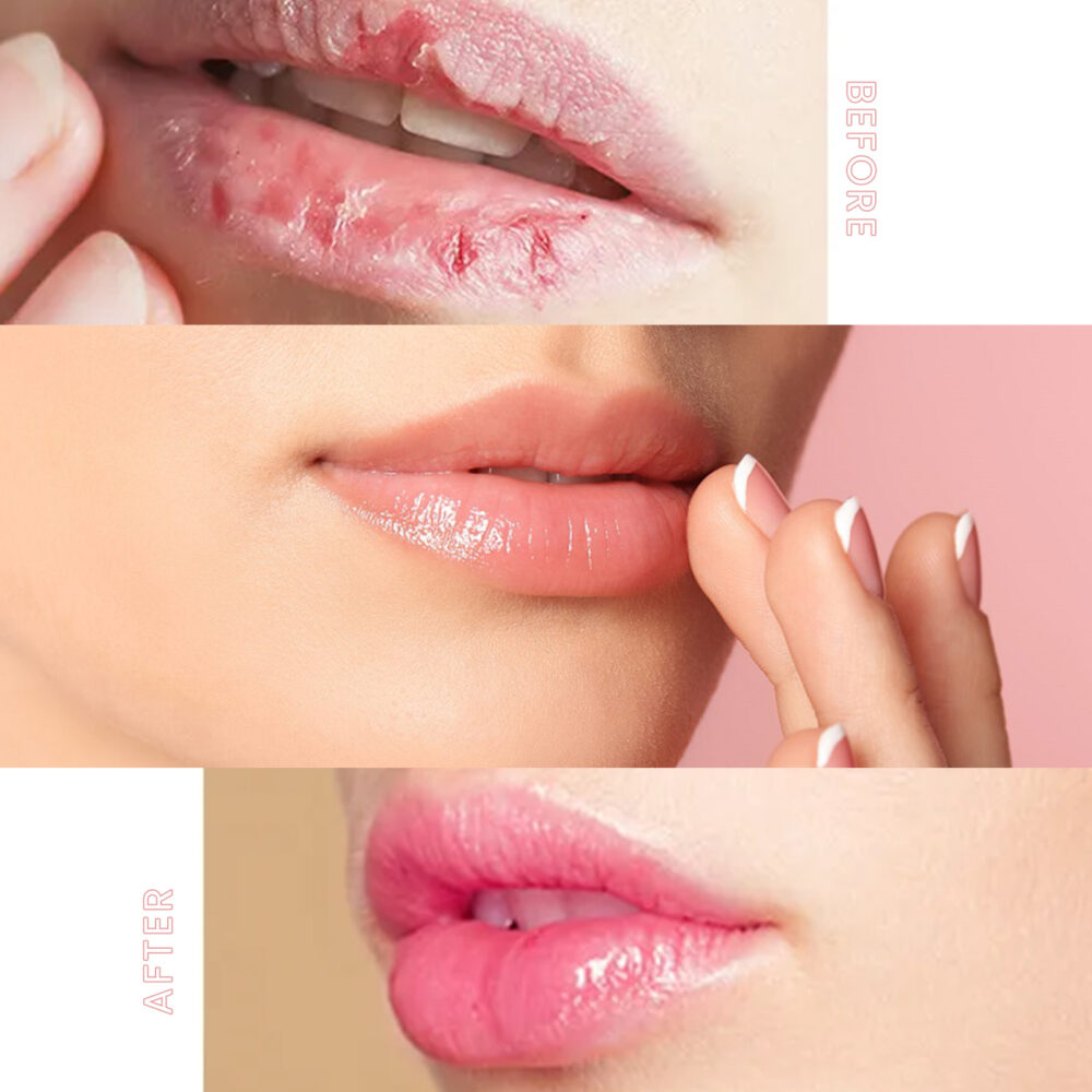 Lip Sleep Mask Moisturizes and gently exfoliates dead skin plump and smooth lip mask #JL04-EEA02-A205-20-VT1 - Image 3