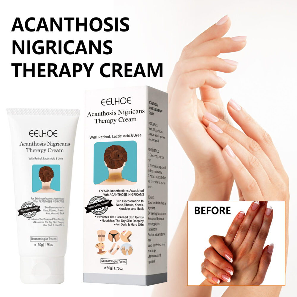 Acanthoderma nigra Repair Cream Repair Underarm arm Knee Joint Black Moisturizing Whitening Body Care cream #JL04-EEA08-A038-50-WH1 - Image 2