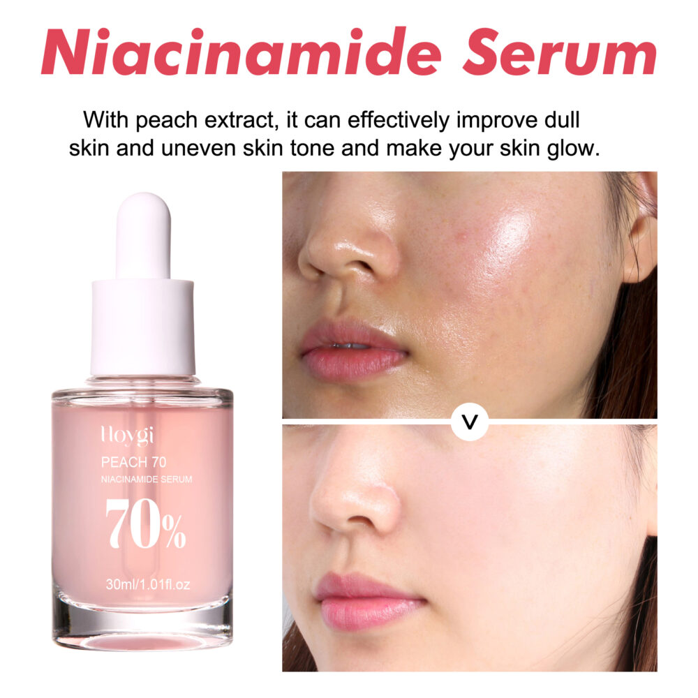 Niacinamide Essence tightens and moisturizes pores, lightens acne marks and spots, moisturizes and brightens skin #JL04-HOA02-A077-30-PK1 - Image 3