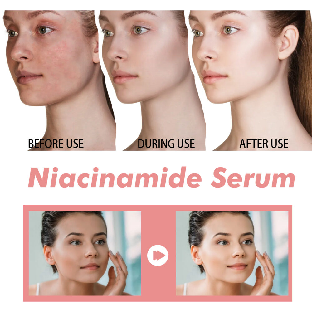 Niacinamide Essence tightens and moisturizes pores, lightens acne marks and spots, moisturizes and brightens skin #JL04-HOA02-A077-30-PK1 - Image 4