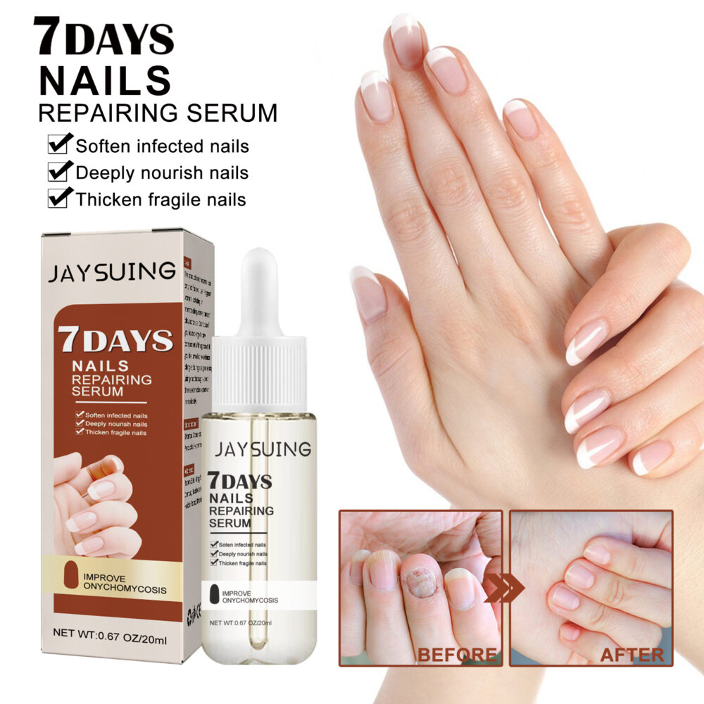 7 Day Nail Repair Essence Repair Nail ThickEning Grey Nail Repair Solution #JL04-JAA04-A003-20-MX1 - Image 2