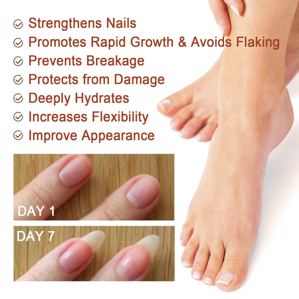 7 Day Nail Repair Essence Repair Nail ThickEning Grey Nail Repair Solution #JL04-JAA04-A003-20-MX1 - Image 4