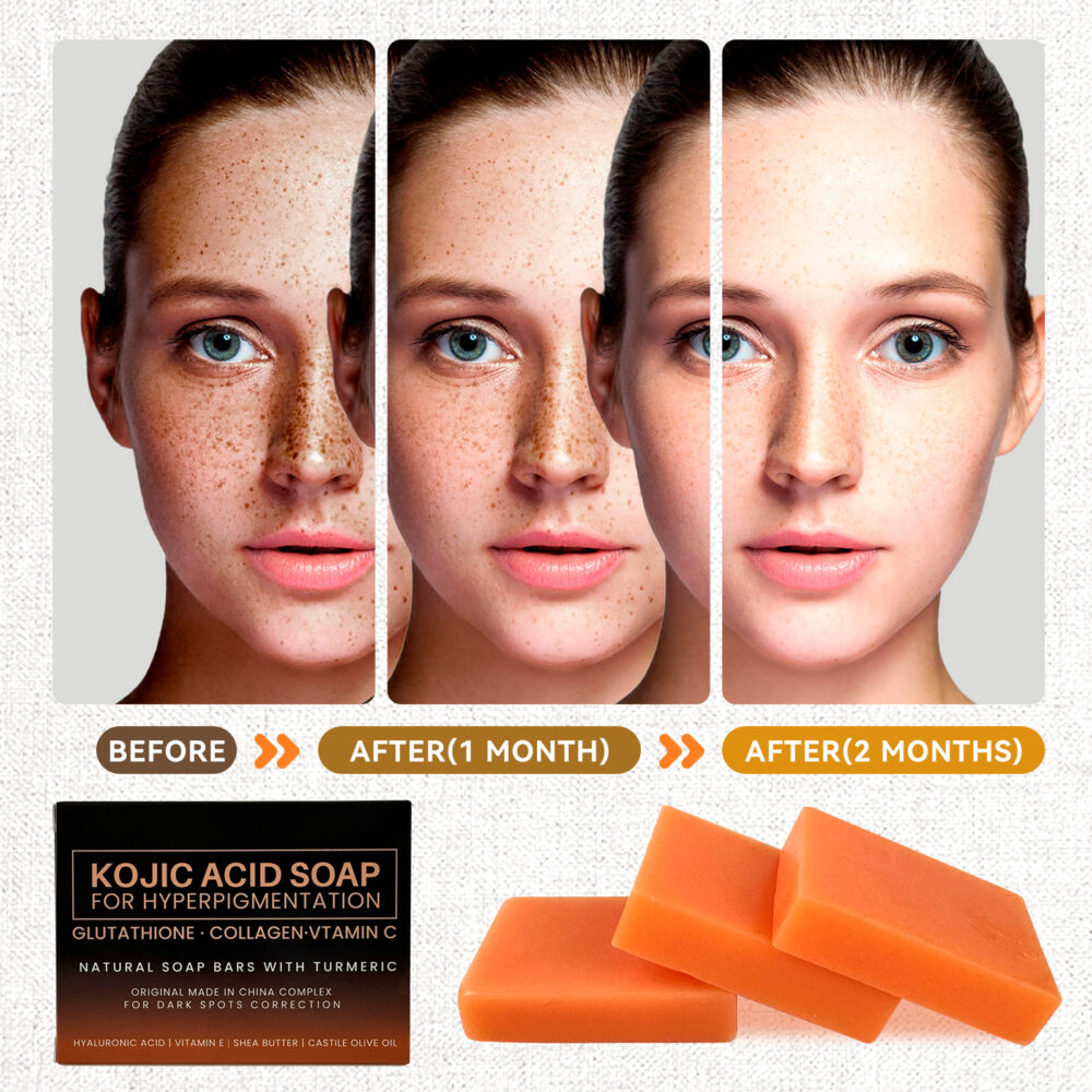 （with bubble net）Kojic Acid Soap for Hyper-pigmentation, Dark Spot Remover,Uneven skin tone，soap bar with Collagen,Kojic Acid,Vitamin E,Vitamin C,  Retinol,  Face & Body #JL05-w13153210