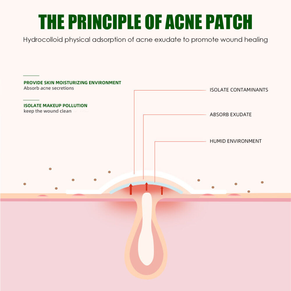 Liquid Acne Patch, Invisible Makeup Artificial Skin Repair Essential Oil Waterproof Concealer Acne Patch Breathable #JL05-w13123756 - Image 2