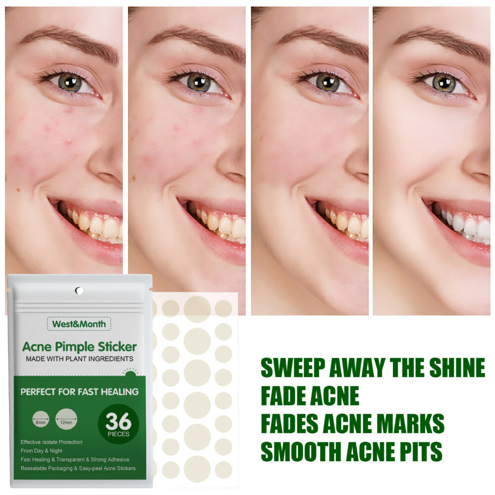 Liquid Acne Patch, Invisible Makeup Artificial Skin Repair Essential Oil Waterproof Concealer Acne Patch Breathable #JL05-w13123756 - Image 5