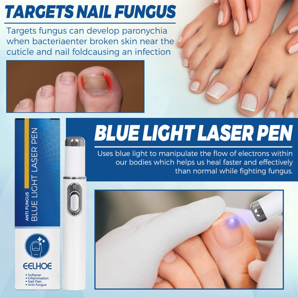 Nail Blue Laser Pointer, Gray Nail Repair Laser Pointer Is Easy To Use To Remove Odor Nail Care #JL05-w13101676