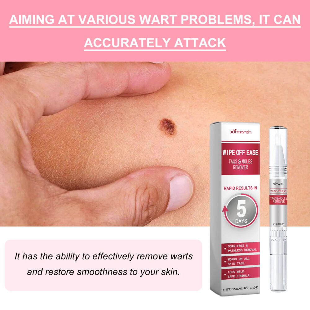 Skin Warts Liquid cleanses skin to remove flat skin especially hand cocoon meat thorn chicken eye warts liquid #JL04-XIA06-A245-3-WH1 - Image 5