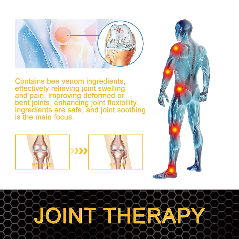 Bee Venom Joint Care Gel relieves aching muscles and bones with gentle care and improves joint stiffness and discomfort #JL04-XIA06-A251-20-YE1 - Image 6