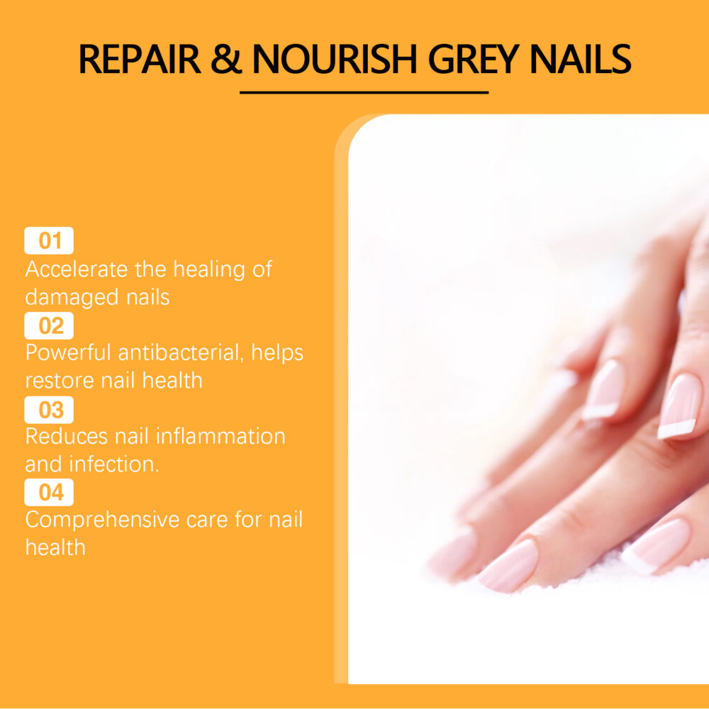 Bee Venom Gray Nail Care Solution Hand and Foot gray Nail cleaning, Repairing, softening and brightening nutritional care solution #JL04-XIB05-A038-15-YE1 - Image 11