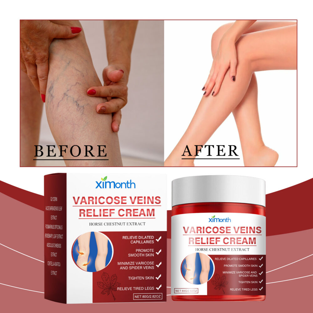 Vein Repair Cream Leg Massage to relieve leg swelling earthworm leg skin body massage cream #JL04-XIB07-A058-80-RD1