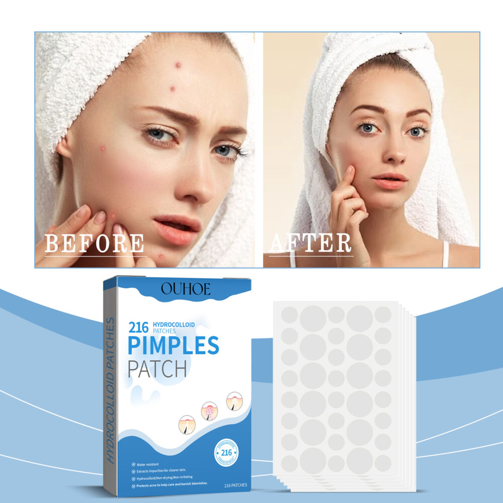 Acne Repair Patch Lighten acne Acne Waterproof Breathable Facial Skin Care Cover Repair Patch #JL04-OUA05-A148-216-BU1