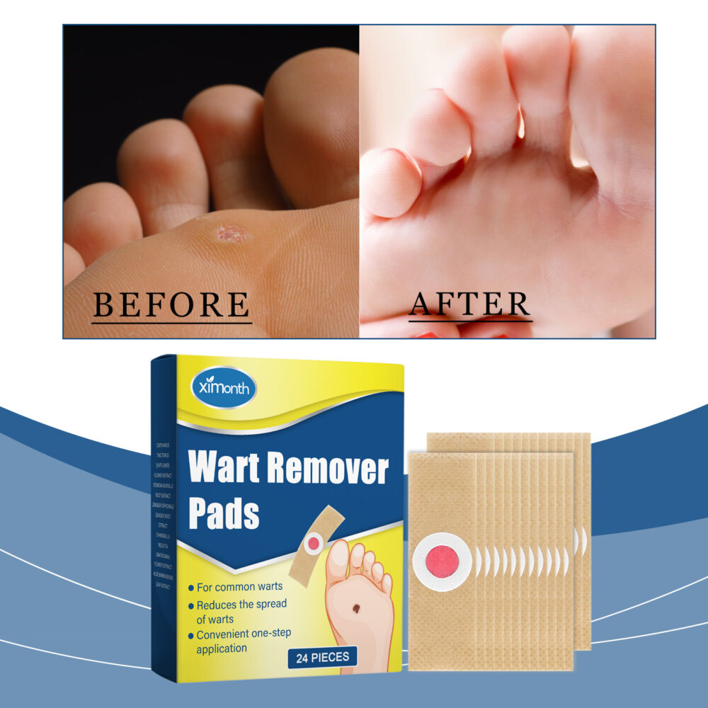 Kero Patch Foot Care Gentle body clean smooth skin external Kero patch corns #JL04-XIB07-A080-24-BU1