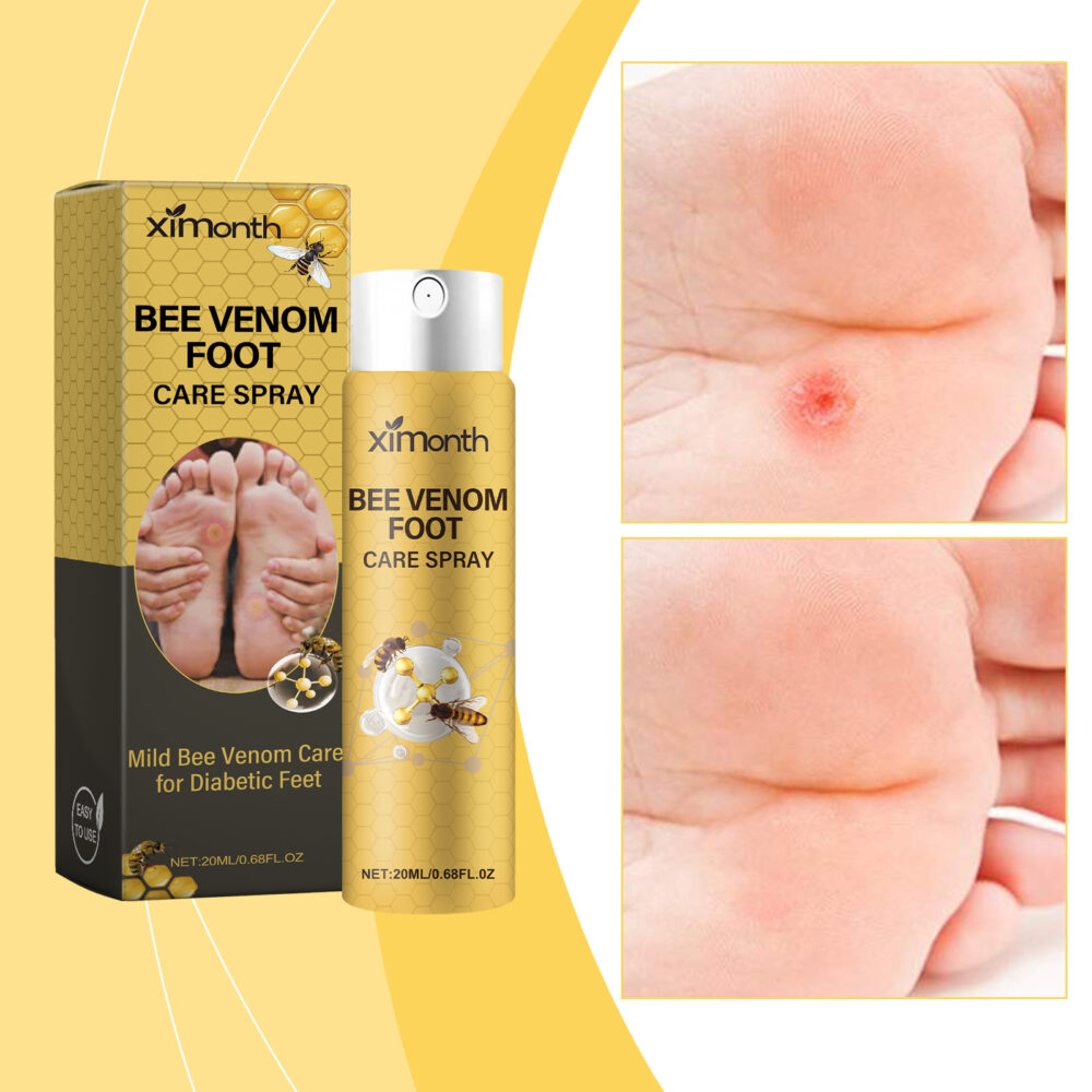 Bee Venom Foot Care Spray relieves swelling, peeling, dry and cracked feet Clean beriberi Moisturizing Spray #JL04-XIB05-A034-20-YE1