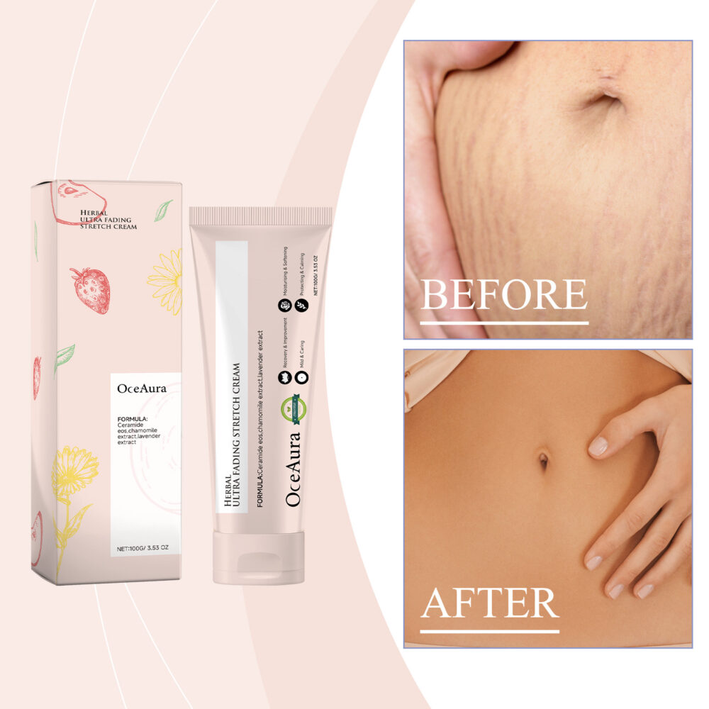 Pregnancy Care Cream Lighten fat marks Postpartum scar repair Smooth skin body care cream #JL04-OCA06-A087-100-PK1