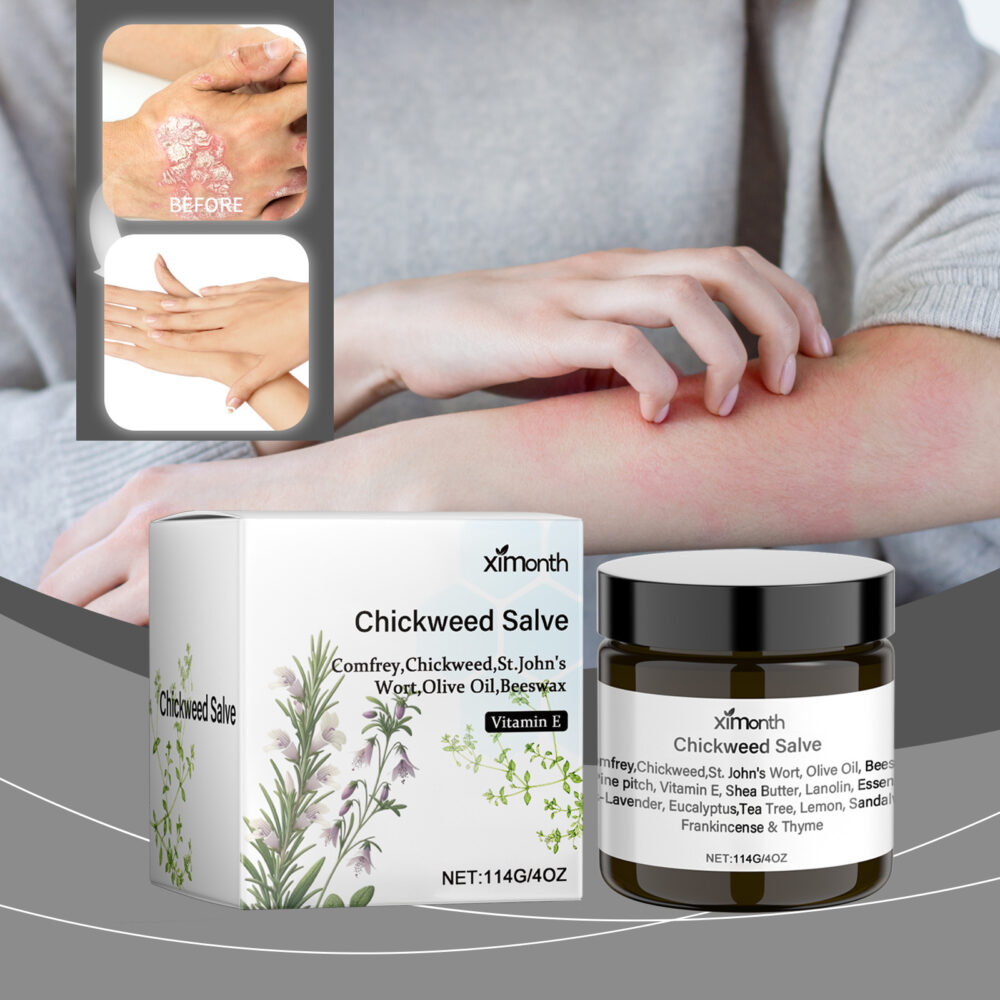 Skin Repair cream Relieves dry, red, itchy and uncomfortable skin itch care cream #JL04-XIB06-A013-114-WH1