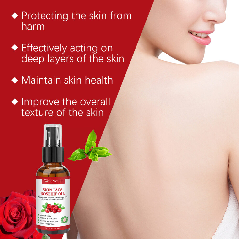 Rosehip Seed Wart Essence Oil lightened skin Flesh granules, moisturized and repaired smooth skin #WM-WEA06-A044-30-WH1 - Image 12