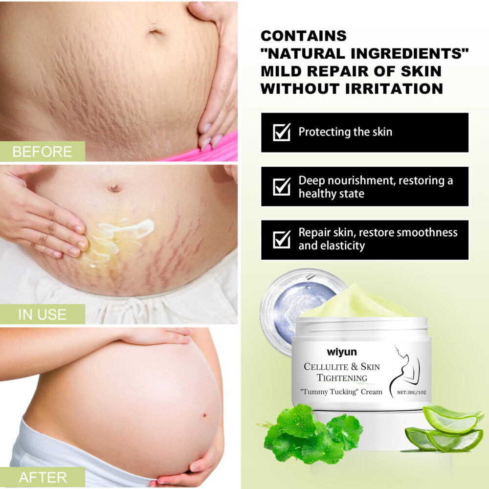 Scar Whitening Cream Moisturizes and smooths skin repair cream for surgical scars and pregnancy wounds #JL04-WYA06-A012-30-WH1 - Image 5