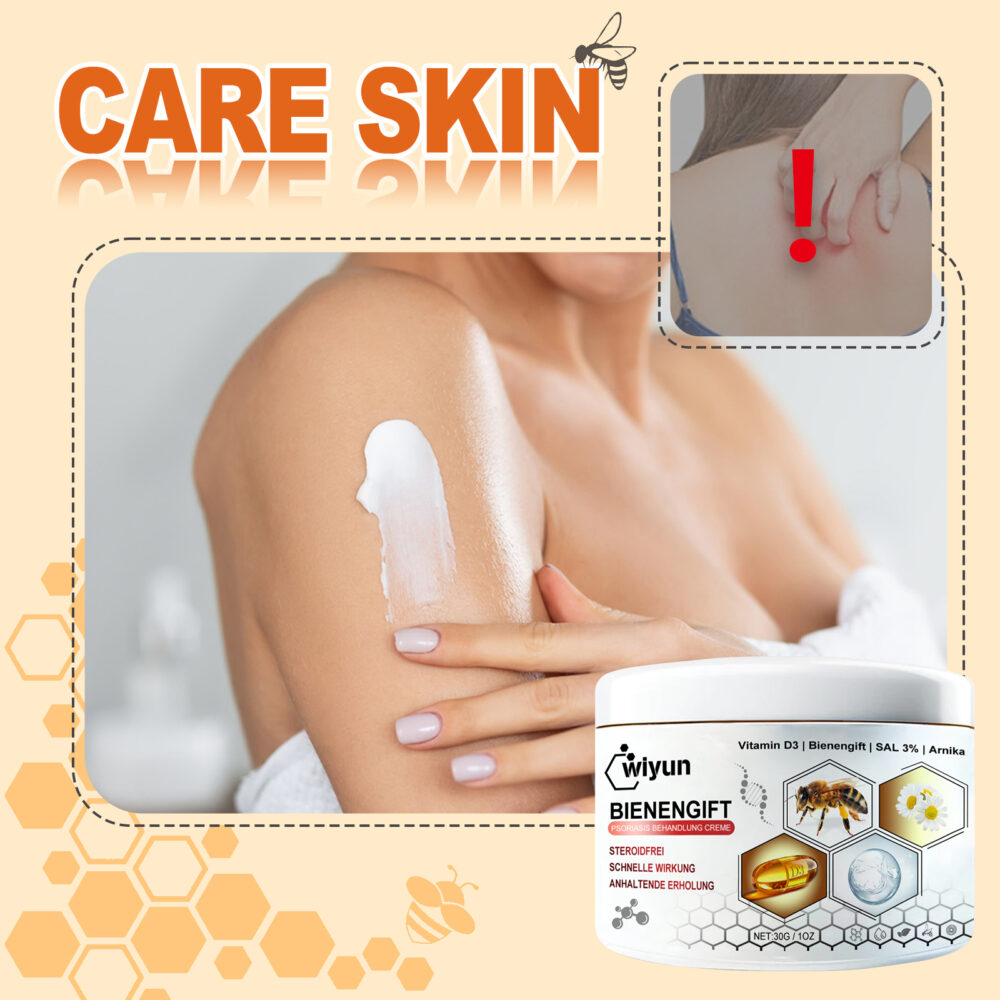 Bee Venom psoriasis Care Cream Relieves itchy, redness and moisturizing skin care cream #JL04-WYA06-A011-30-WH1 - Image 5