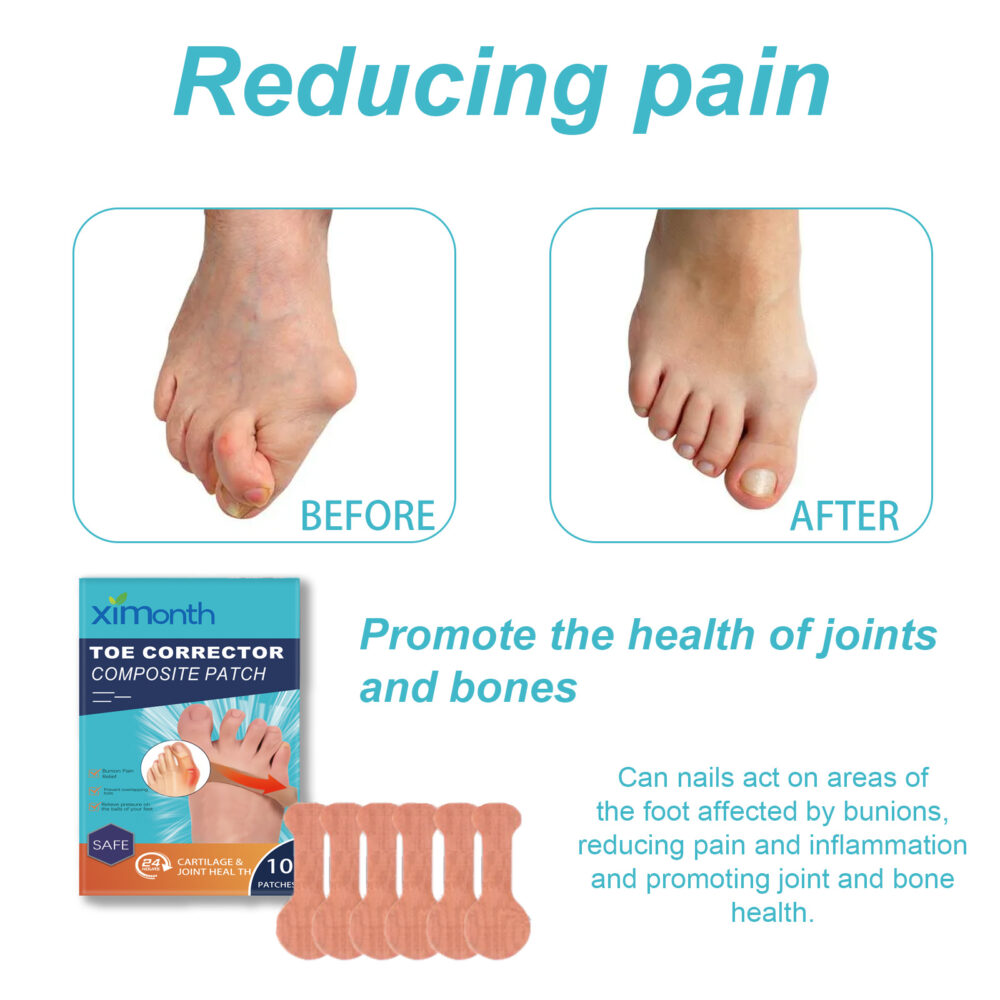 Corrective foot pads relieve pain and swelling of the big toe valgus joint Foot care Corrective foot pads #JL04-XIB05-A018-33-BU1 - Image 6