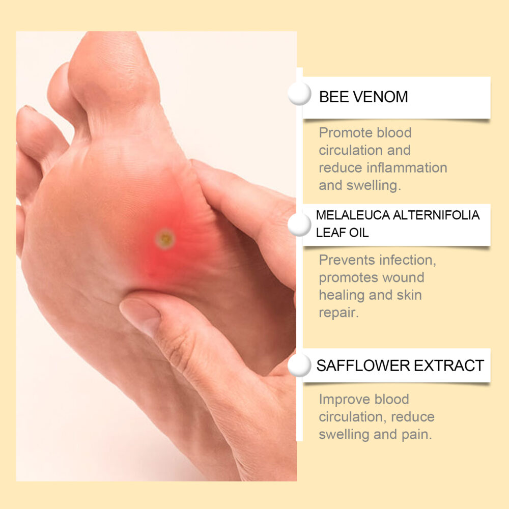 Bee Venom Foot Care Spray relieves swelling, peeling, dry and cracked feet Clean beriberi Moisturizing Spray #JL04-XIB05-A034-20-YE1 - Image 5