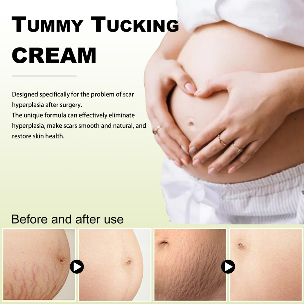 Scar Whitening Cream Moisturizes and smooths skin repair cream for surgical scars and pregnancy wounds #JL04-WYA06-A012-30-WH1 - Image 7