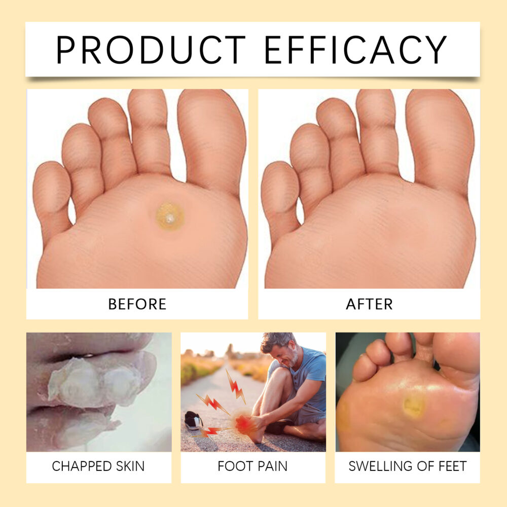 Bee Venom Foot Care Spray relieves swelling, peeling, dry and cracked feet Clean beriberi Moisturizing Spray #JL04-XIB05-A034-20-YE1 - Image 9