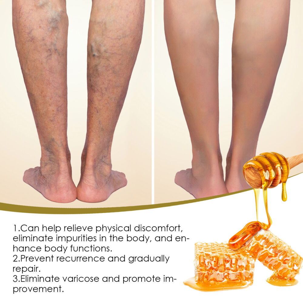 Bee Venom Foot Bath Gel relieves leg swelling Repair Veins Firming Body Shaping Foot Bath Pack #JL04-SOB07-A008-7-WH1 - Image 4