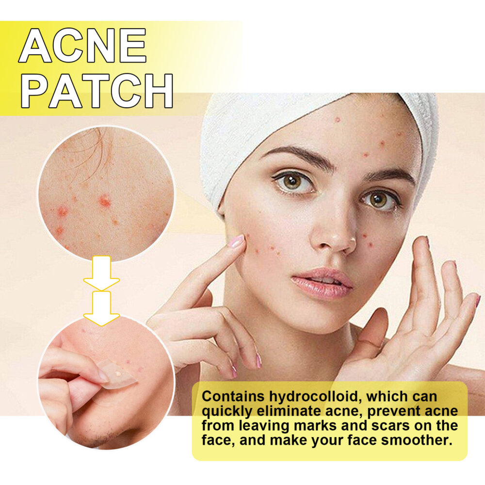 Acne Hydrocolloidal Patch Cleanses facial acne, closes mouth, removes blackheads and delicate skin patch #JL04-JAA05-A001-20-YE1 - Image 4