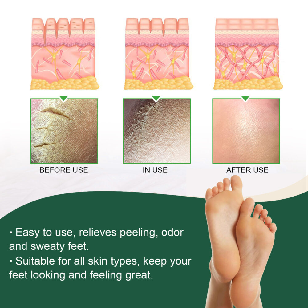 Foot Bath Gel relieves body fatigue, relaxes body and mind, moisturizes skin care gel #JL04-SOB05-A001-10-WH1 - Image 6